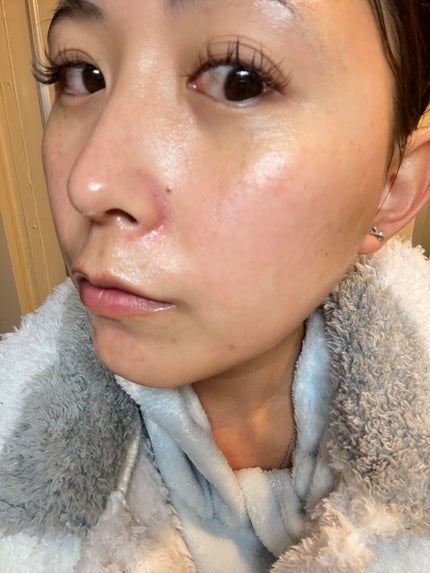 æ¡éŠð·LIPSããŒãããŒâ€ïžâð¥ on LIPS ãçŸå®¹èšé²ââªÂ·Í·âê³â€ïžâð¥ããŒãããŒãªã³ã°ð¿æè¿æµè¡ã£ãŠã..ãïŒ7æç®ïŒ