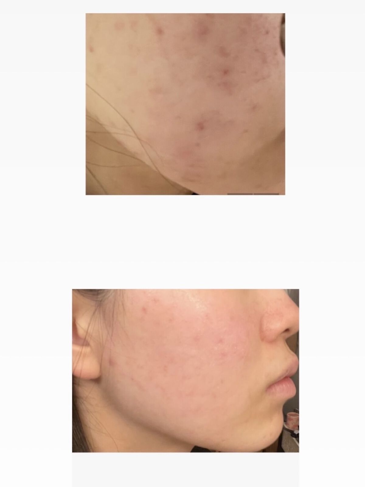 オールクリアオイル/SENKA（専科）/オイルクレンジングを使ったクチコミ（2枚目）