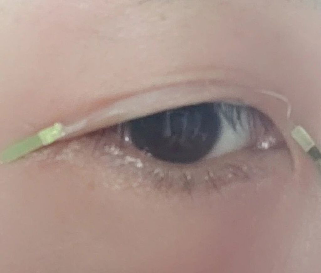 マイクロファイバー /ビー・エヌ/二重まぶた用アイテムを使ったクチコミ(3枚目)