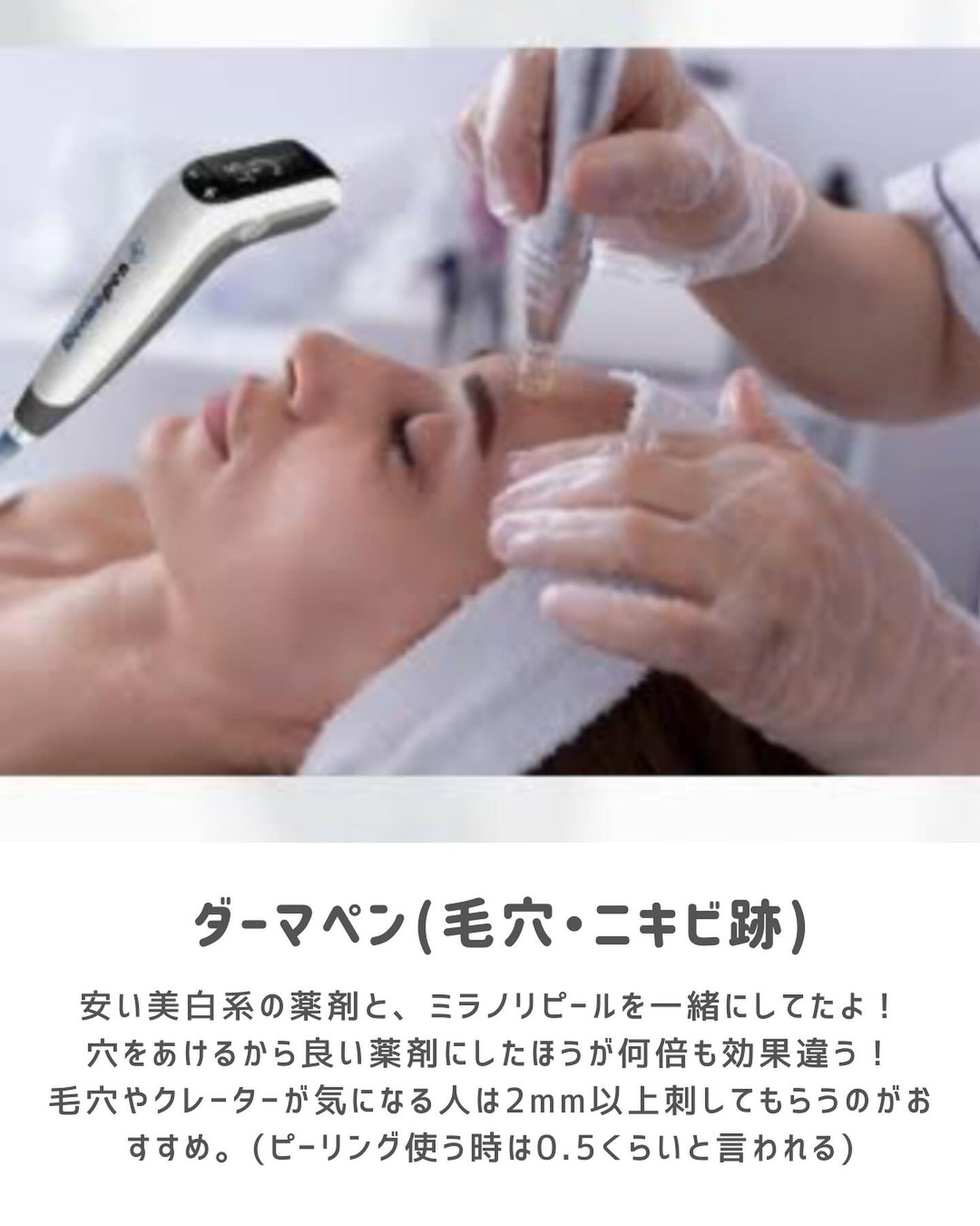 あずさ@スキンケアマニア on LIPS 「ニキビ・毛穴に悩んだ 効果あった美容医療何か質問あればぜひコメ..」(4枚目)