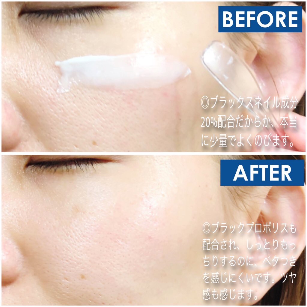 ブラックスネイル クリーム/Dr.G/フェイスクリームを使ったクチコミ（3枚目）