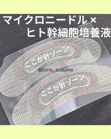 ジュエリアプレミアム マイクロパッチ/ジュエリアプレミアム/シートマスク・パックを使ったクチコミ(2枚目)