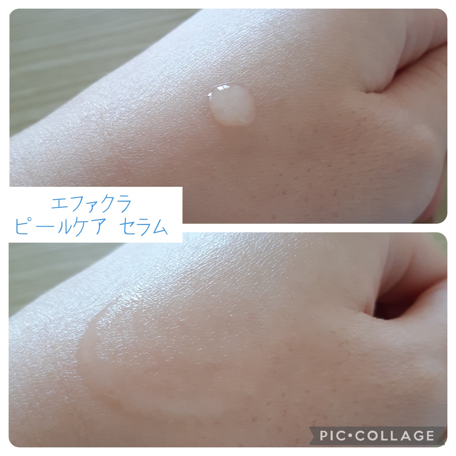 エファクラ ピールケア セラム/ラ ロッシュ ポゼ/美容液を使ったクチコミ（3枚目）