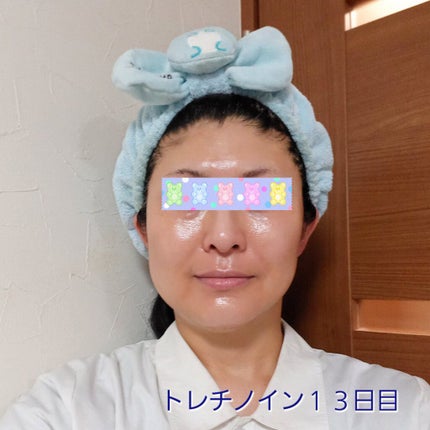 極潤α リフトクリーム/肌ラボ/フェイスクリームを使ったクチコミ(1枚目)