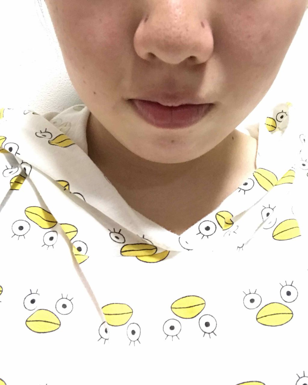 薬用 しみ 集中対策 美容液/メラノCC/美容液を使ったクチコミ(2枚目)