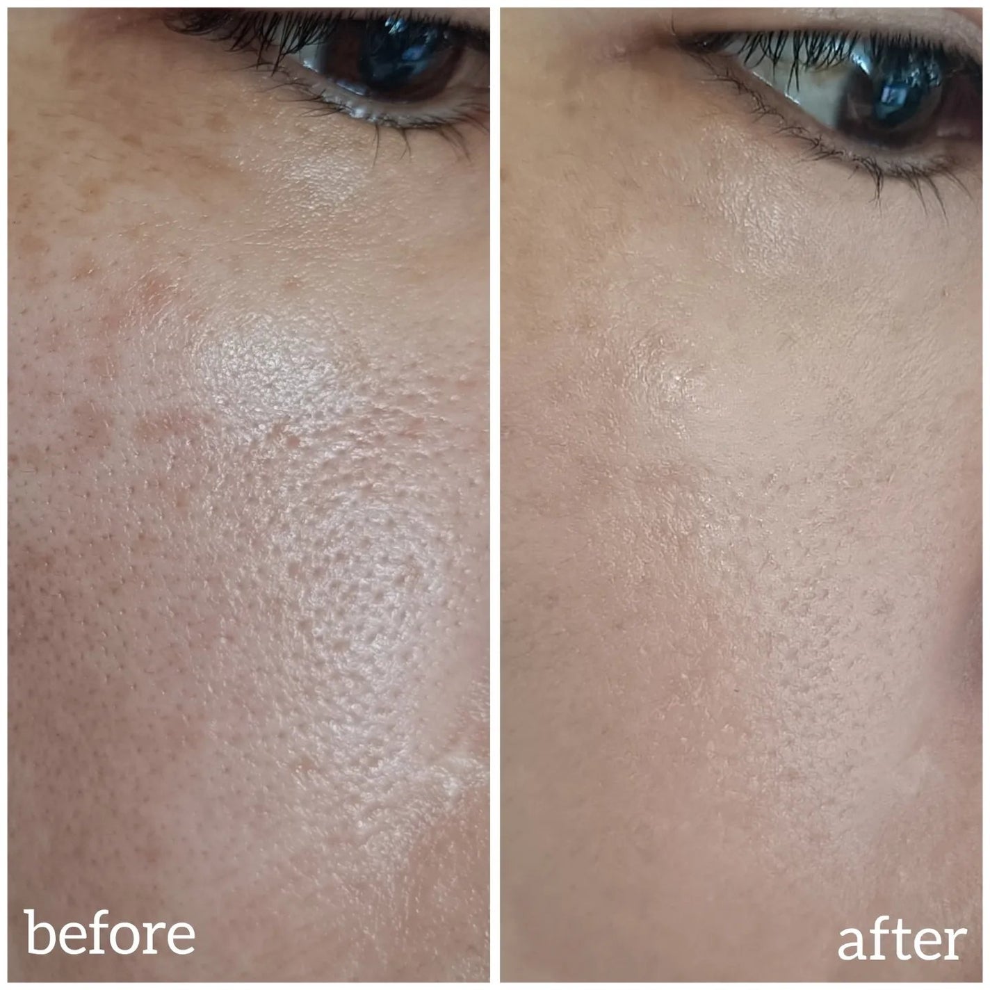 薬用クリアエステヴェール/Macchia Label/リキッドファンデーションを使ったクチコミ(4枚目)