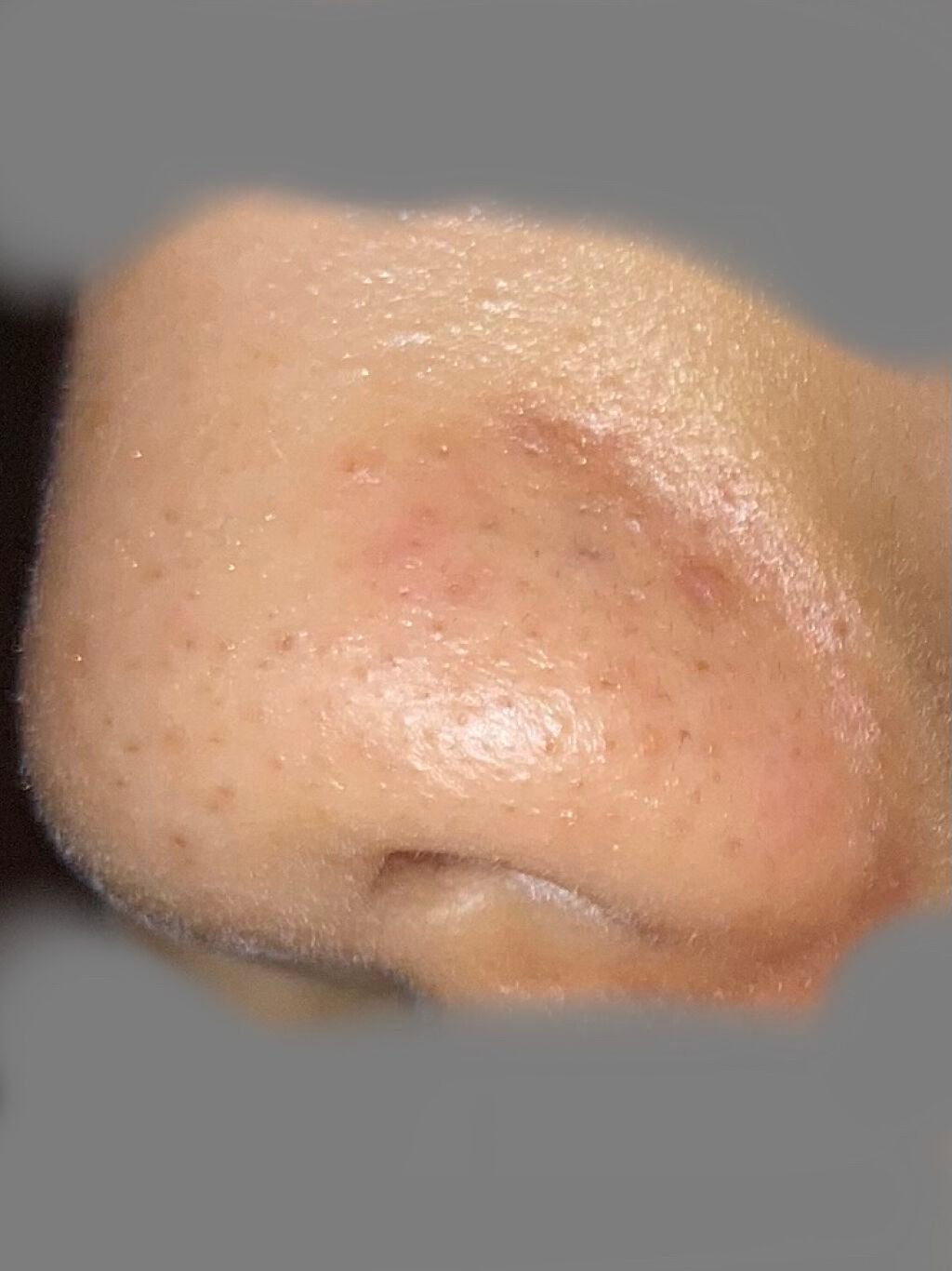 オリジナル ピュアスキンジェリー/ヴァセリン/ボディクリームを使ったクチコミ(3枚目)