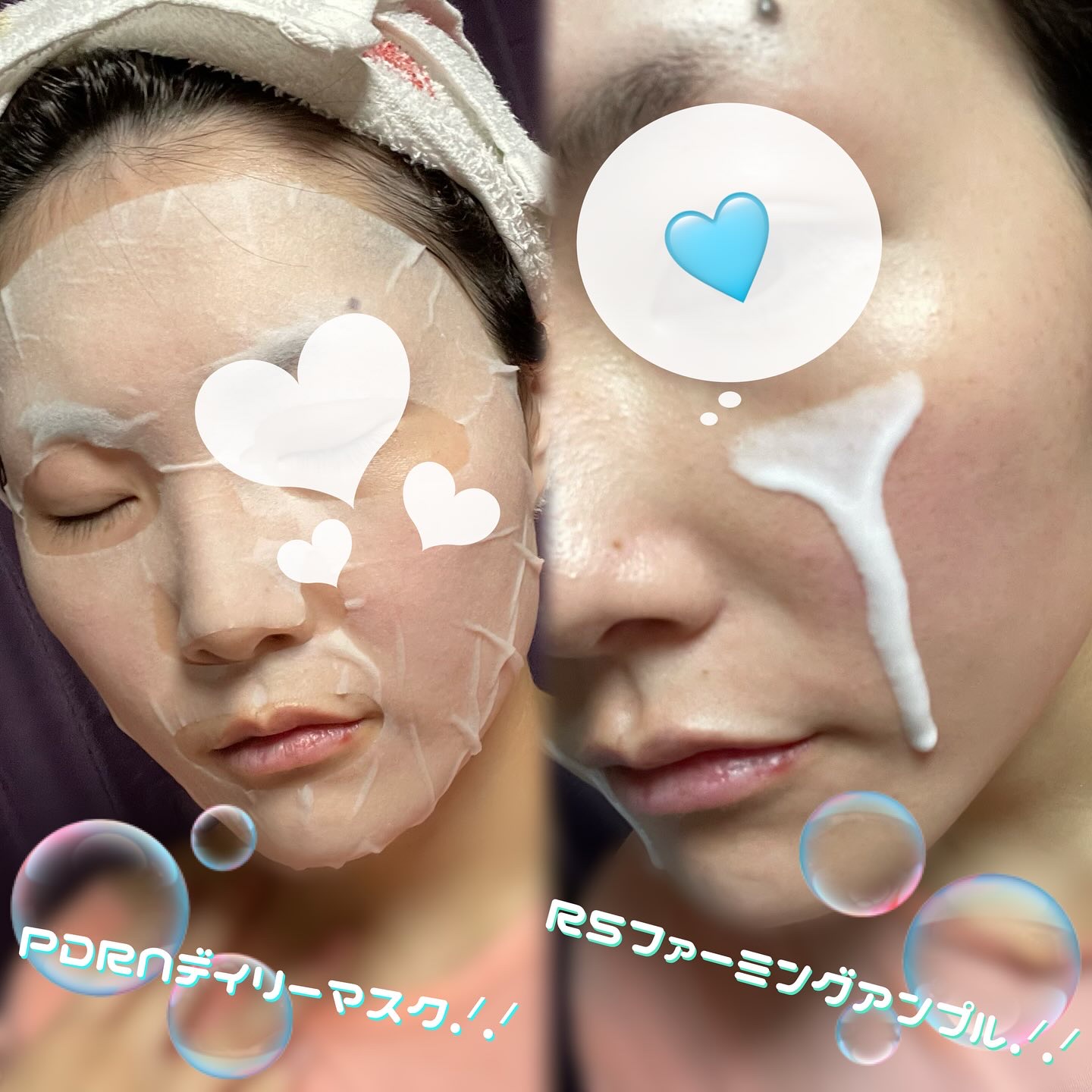 PDRN リードルショット100/VT/ブースター・導入液を使ったクチコミ（2枚目）