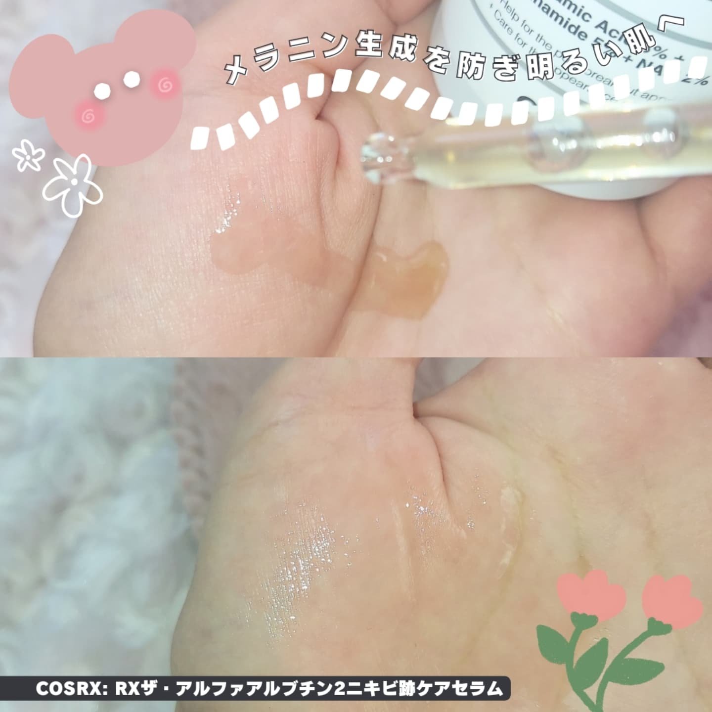 RXザ・アルファアルブチン2 ニキビ跡ケアセラム/COSRX/美容液を使ったクチコミ（3枚目）