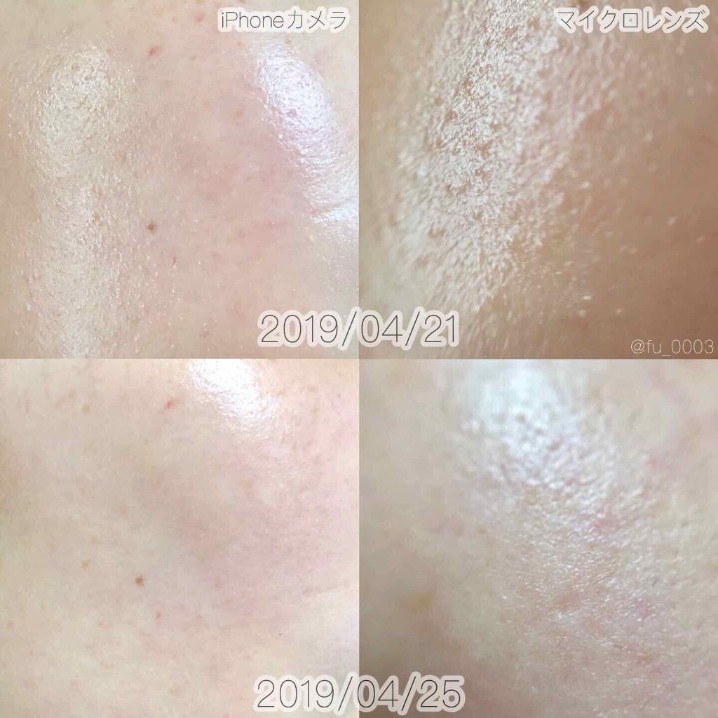 リポタッチ フェイスセラム/リポタッチ/美容液を使ったクチコミ(3枚目)