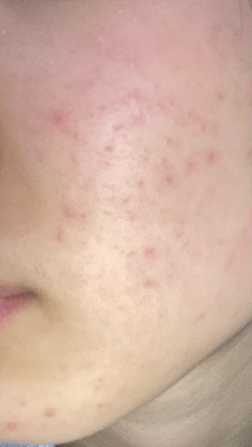 ティーツリーケア クレンジングフォーム JEX/MEDIHEAL/洗顔フォームを使ったクチコミ（1枚目）