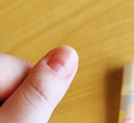 ケアジェリー/Decorative Nail/ネイルオイル・トリートメントを使ったクチコミ(6枚目)
