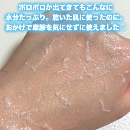 ブライトニングピーリングジェル/Dr.G/ピーリングを使ったクチコミ(6枚目)