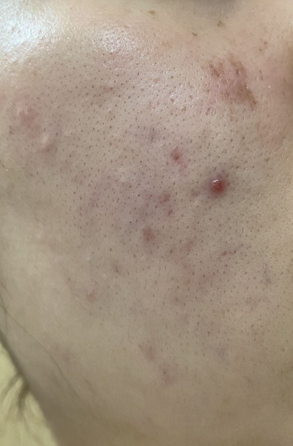 潤浸保湿 フェイスクリーム/キュレル/フェイスクリームを使ったクチコミ（2枚目）