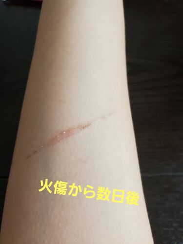 試してみた アットノン アットノンc Exクリーム 医薬品 Lips