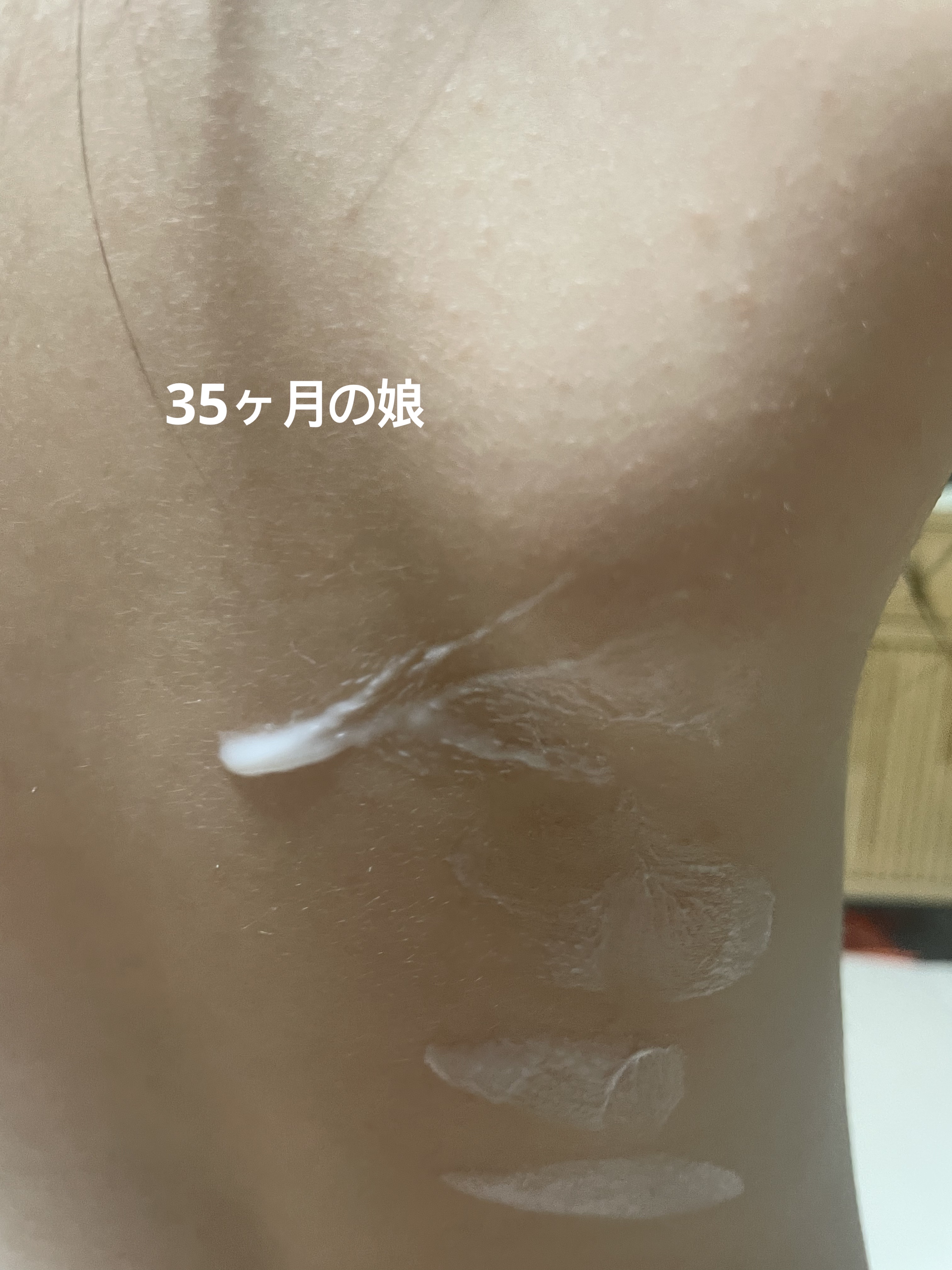 ドクターバリアATOピーエスエルローション/Dr.Barrier/化粧水を使ったクチコミ（2枚目）