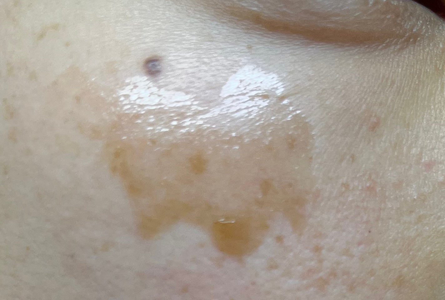 レディブラン ハイドロキールパックHQ/シーヴァ/洗い流すパック・マスクを使ったクチコミ(3枚目)