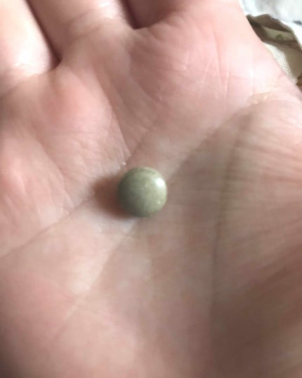 イースト×エンザイムダイエット/メタボリック/ボディサプリメントを使ったクチコミ(4枚目)