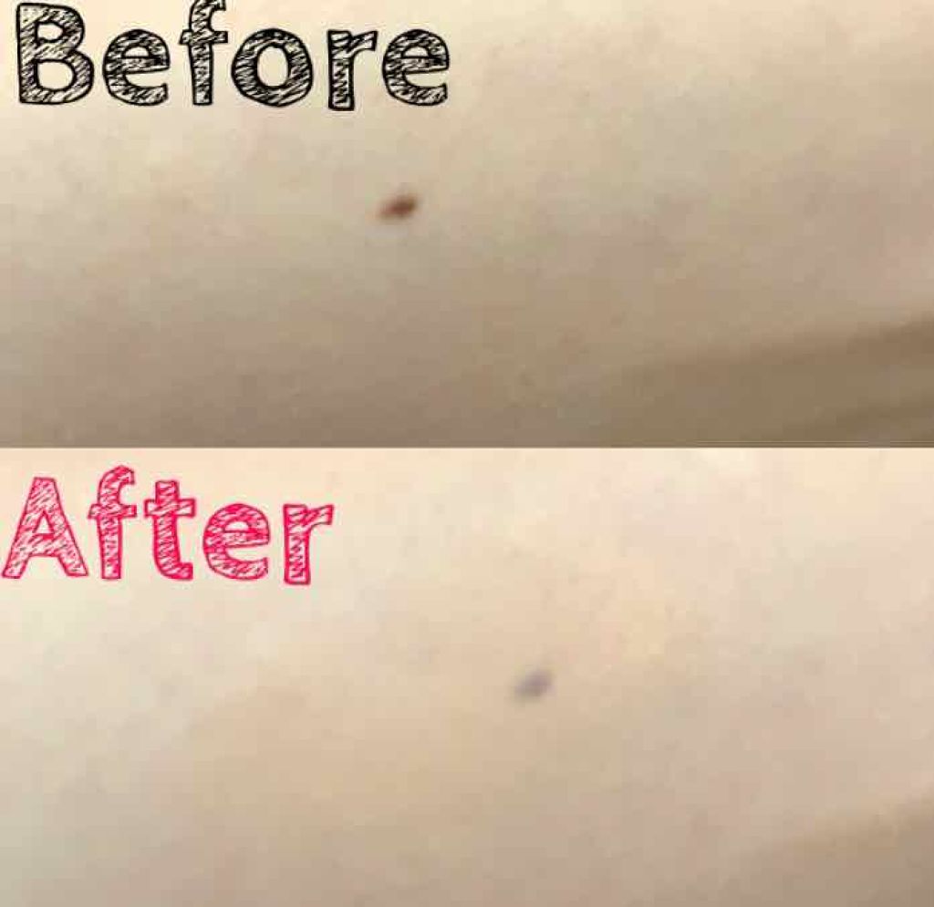 ストレッチコンシーラー/CEZANNE/リキッドコンシーラーを使ったクチコミ(2枚目)