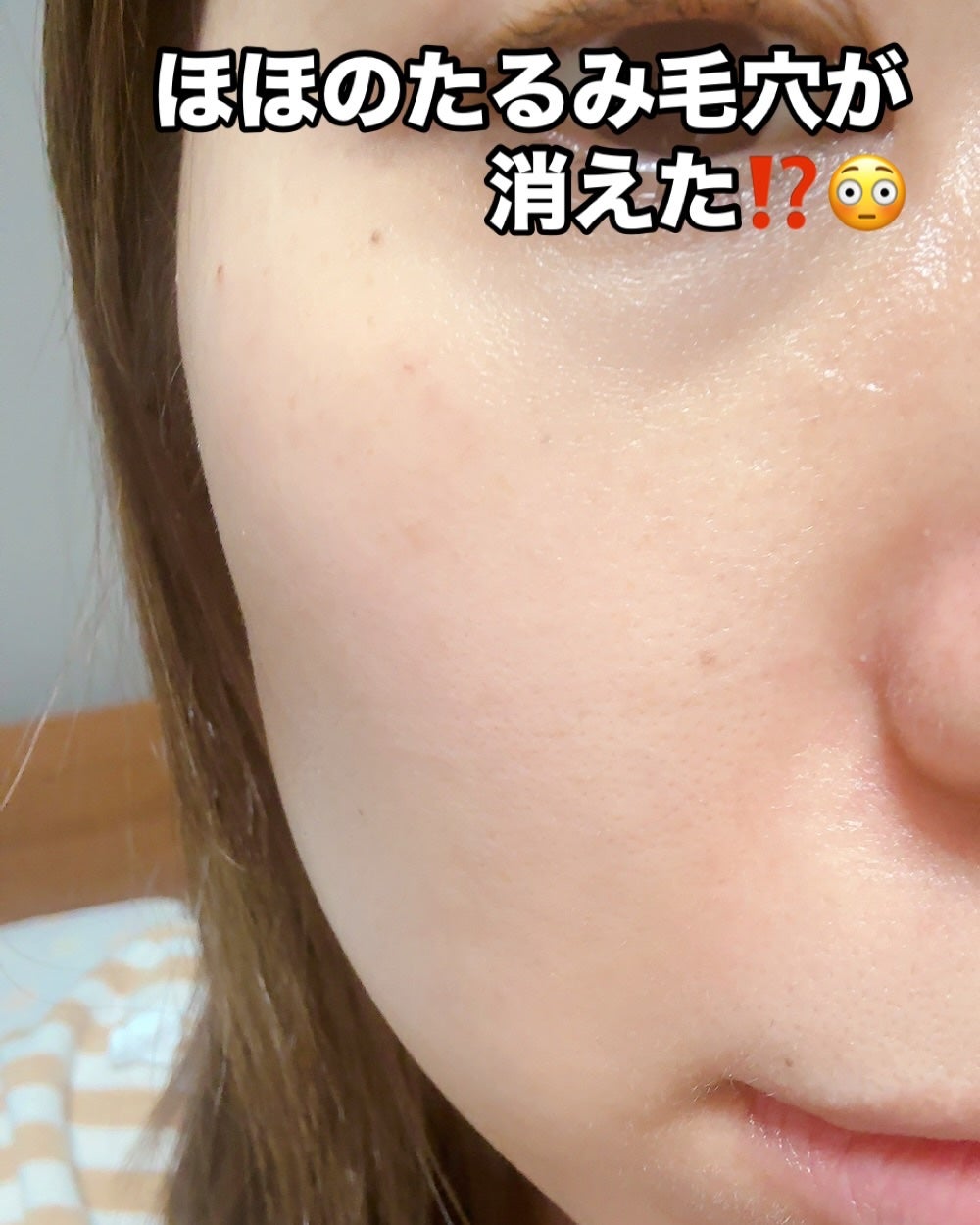 ディープコラーゲン/アンチリンクルリフティングマスク/SUNGBOON EDITOR(成分エディター)/シートマスク・パックを使ったクチコミ(5枚目)