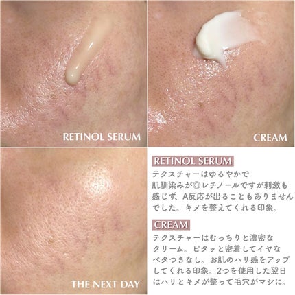 ブラックスネイル クリーム/Dr.G/フェイスクリームを使ったクチコミ(4枚目)