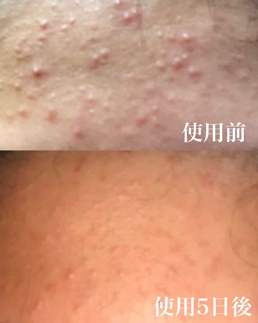 いつかの石けん  ねりタイプ/水橋保寿堂製薬/洗顔フォームを使ったクチコミ（3枚目）