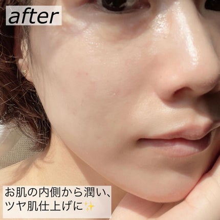 プレミアム シカ モデリング マスクセット/Dr.Althea/シートマスク・パックを使ったクチコミ(6枚目)