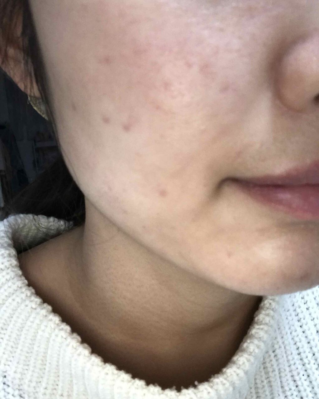 泡洗顔料 しっとりタイプ/オードムーゲ/泡洗顔を使ったクチコミ（1枚目）