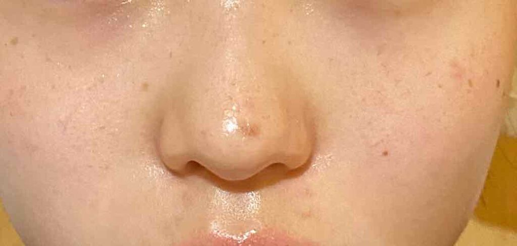 精製水（医薬品）/健栄製薬/その他を使ったクチコミ（3枚目）