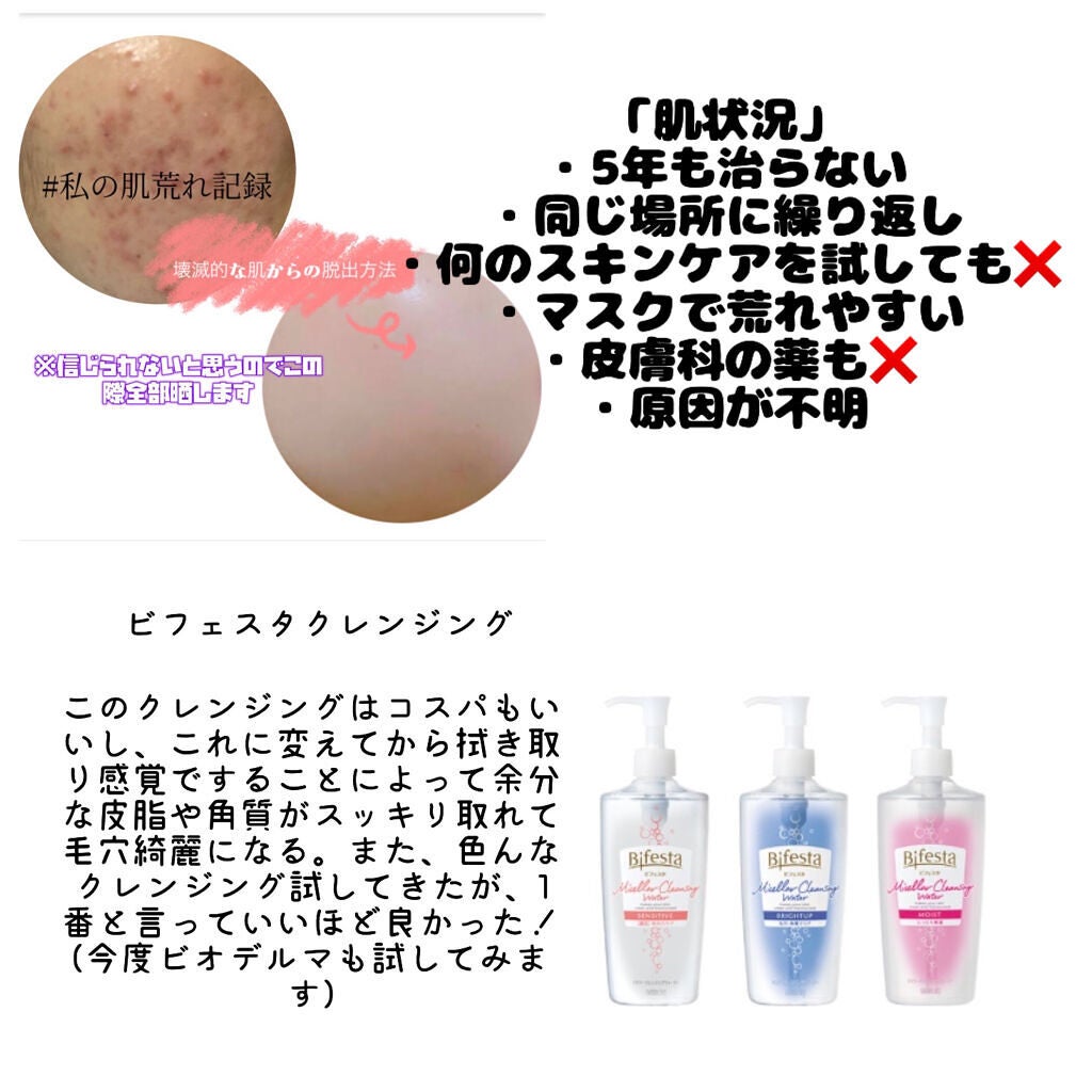 DHC ビタミンBミックス/DHC/美容サプリメントを使ったクチコミ(2枚目)