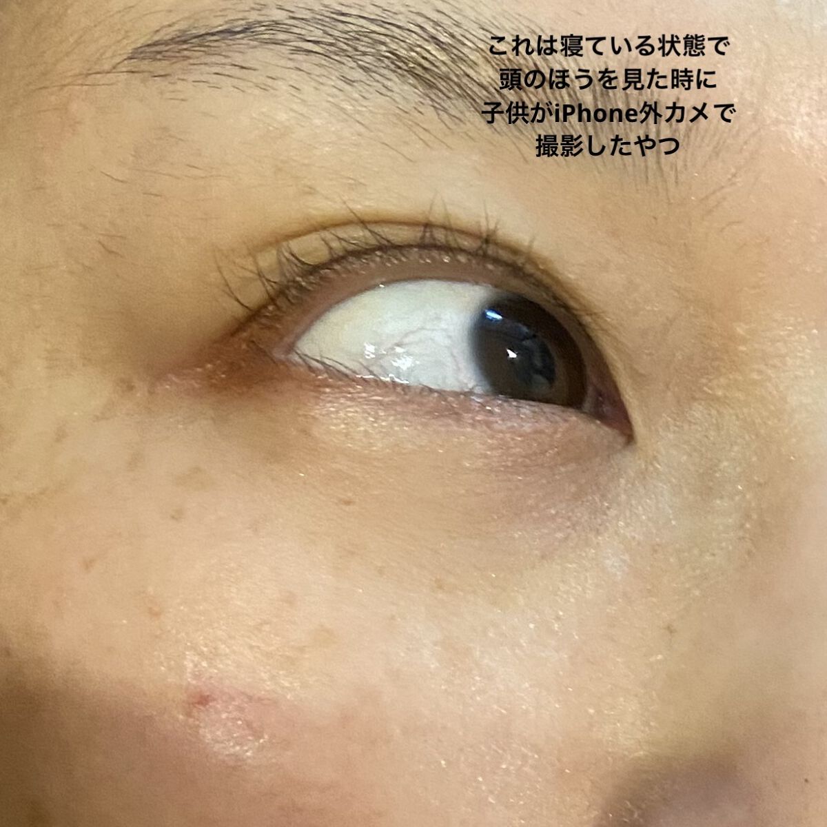 プロバイオダーム リフティング アイリンクルクリーム/BIOHEAL BOH/アイケア・アイクリームを使ったクチコミ（2枚目）