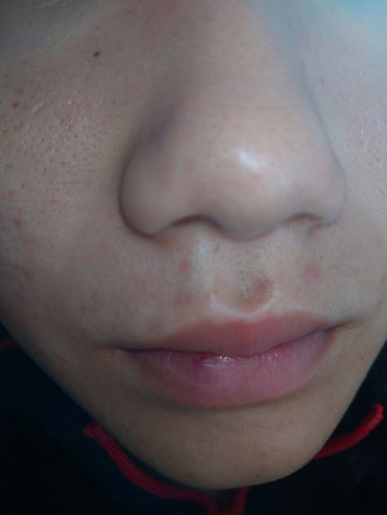 皮脂トラブルケア 化粧水/キュレル/化粧水を使ったクチコミ(2枚目)