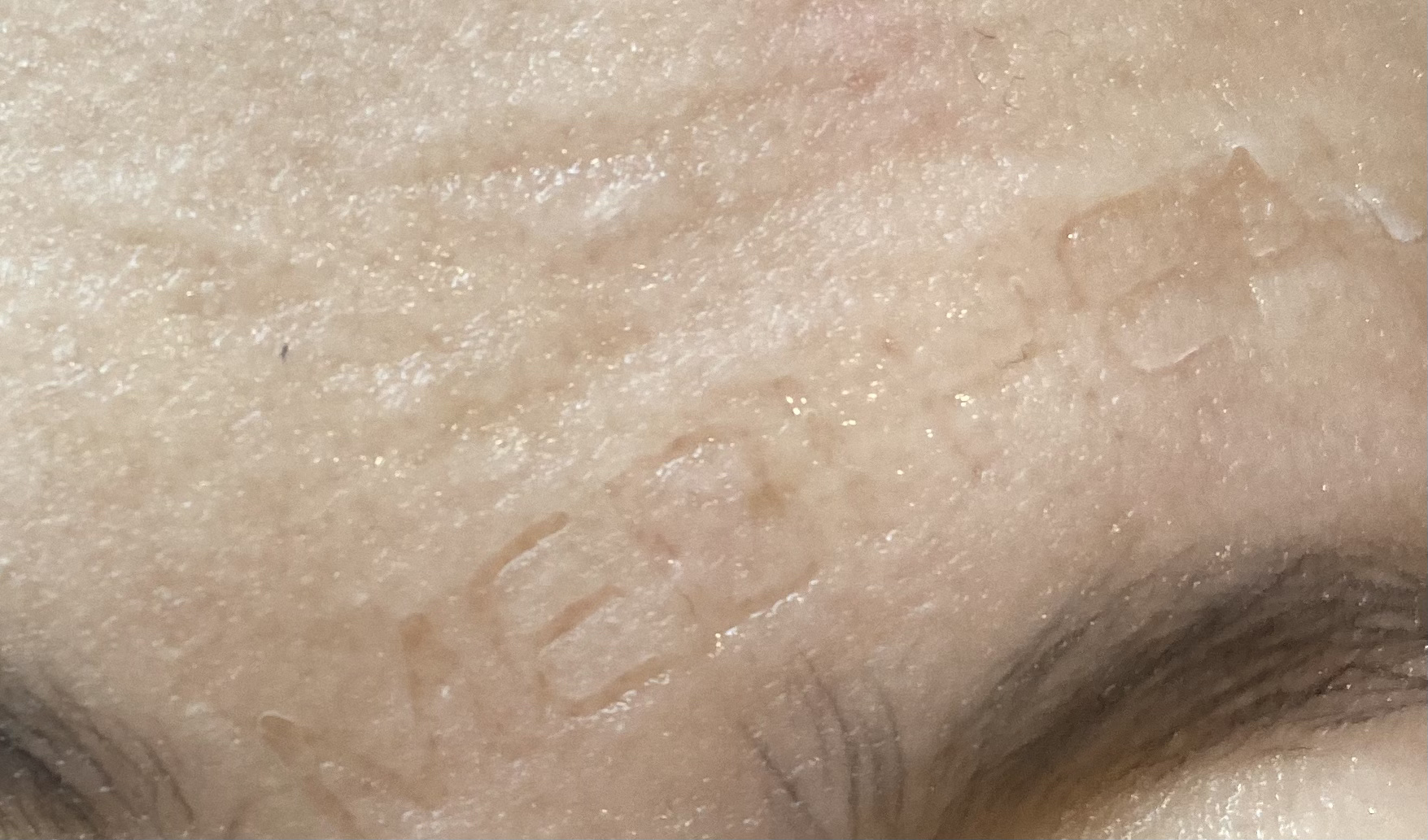 I.P.IライトマックスAPマスクEX/MEDIHEAL/シートマスク・パックを使ったクチコミ（3枚目）