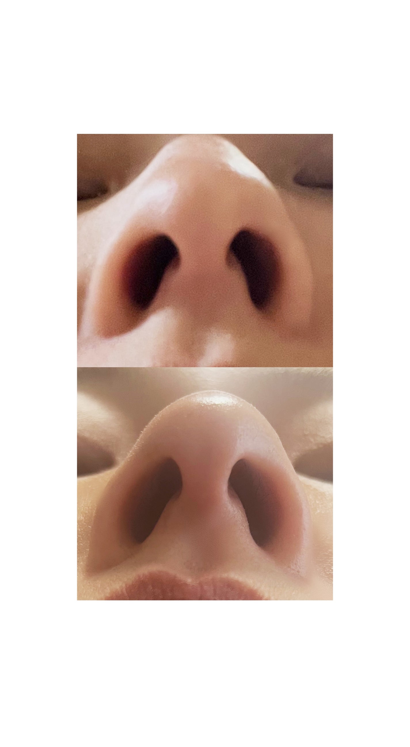 Fornez(フォーネス)/LUXCEAR/美顔器・マッサージを使ったクチコミ(5枚目)