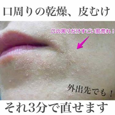 ナチュリエ ハトムギ化粧水 ナチュリエ スキンコンディショナー H ナチュリエを使った口コミ 最近寒くなってきて乾燥もしやすくなり乾燥肌 By 乾燥肌 10代後半 Lips