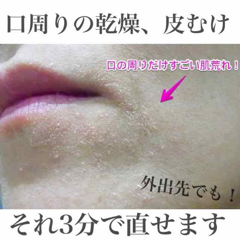 ナチュリエ ハトムギ化粧水 ナチュリエ スキンコンディショナー H ナチュリエを使った口コミ 最近寒くなってきて乾燥もしやすくなり乾燥肌 By 乾燥肌 10代後半 Lips ナチュリエ ハトムギ化粧水 ナチュリエ スキンコンディショナー H ナチュリエを使った口コミ 最近寒くなってきて乾燥もしやすくなり乾燥肌 By 乾燥肌 10代後半 Lips