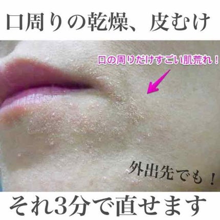 ハトムギ化粧水(ナチュリエ スキンコンディショナー R )/ナチュリエ/化粧水を使ったクチコミ(1枚目)