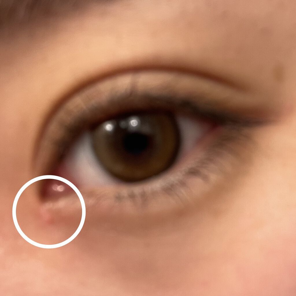 つぶぽろん目元温和漢/つぶぽろん/アイケア・アイクリームを使ったクチコミ（2枚目）