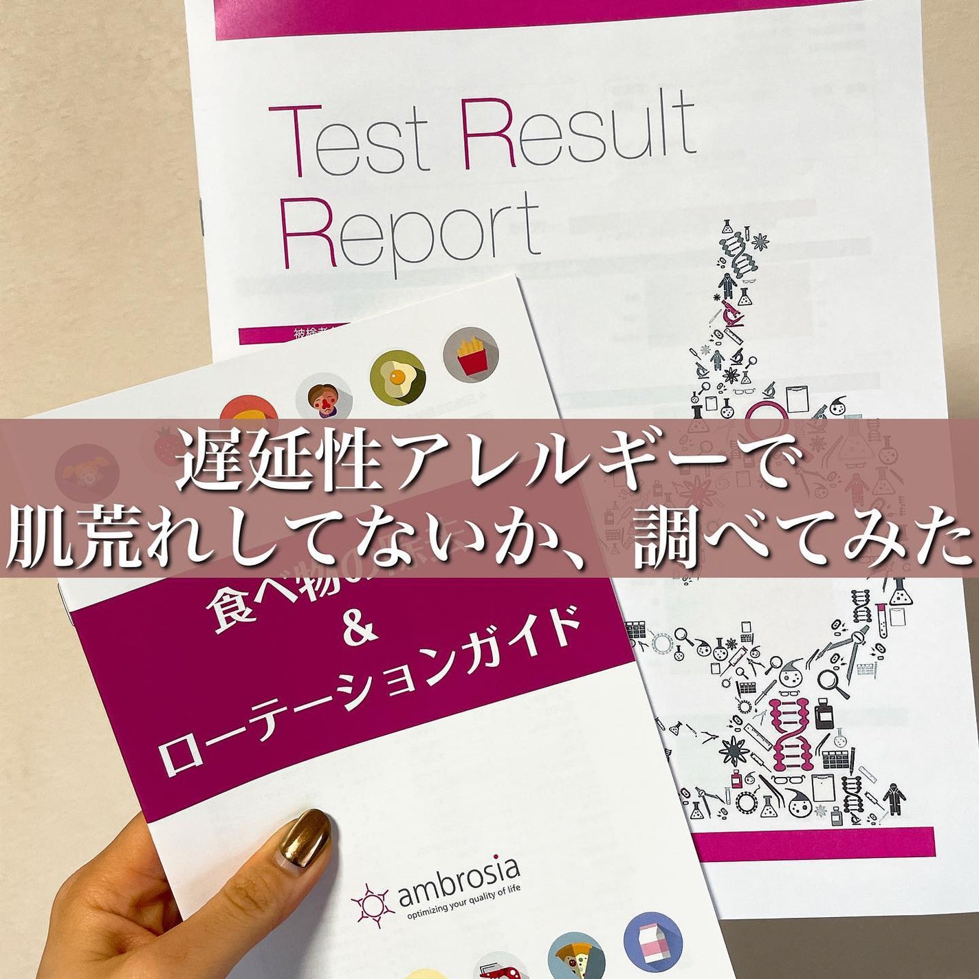 おゆみ|ニキビ・ニキビ跡ケア on LIPS 「【原因不明が一番気持ち悪くない?ニキビの原因を探ろう!】..」(1枚目)