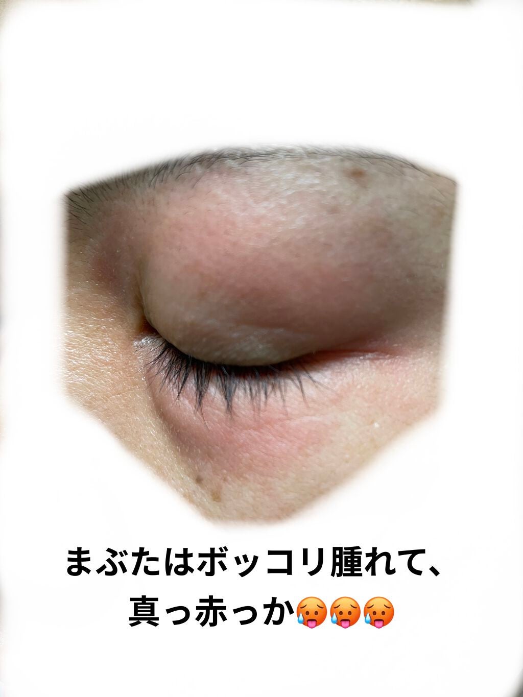 くるみ on LIPS 「新年から肌荒れのことしか投稿できてなくて本当に悲しいのですが...」(2枚目)