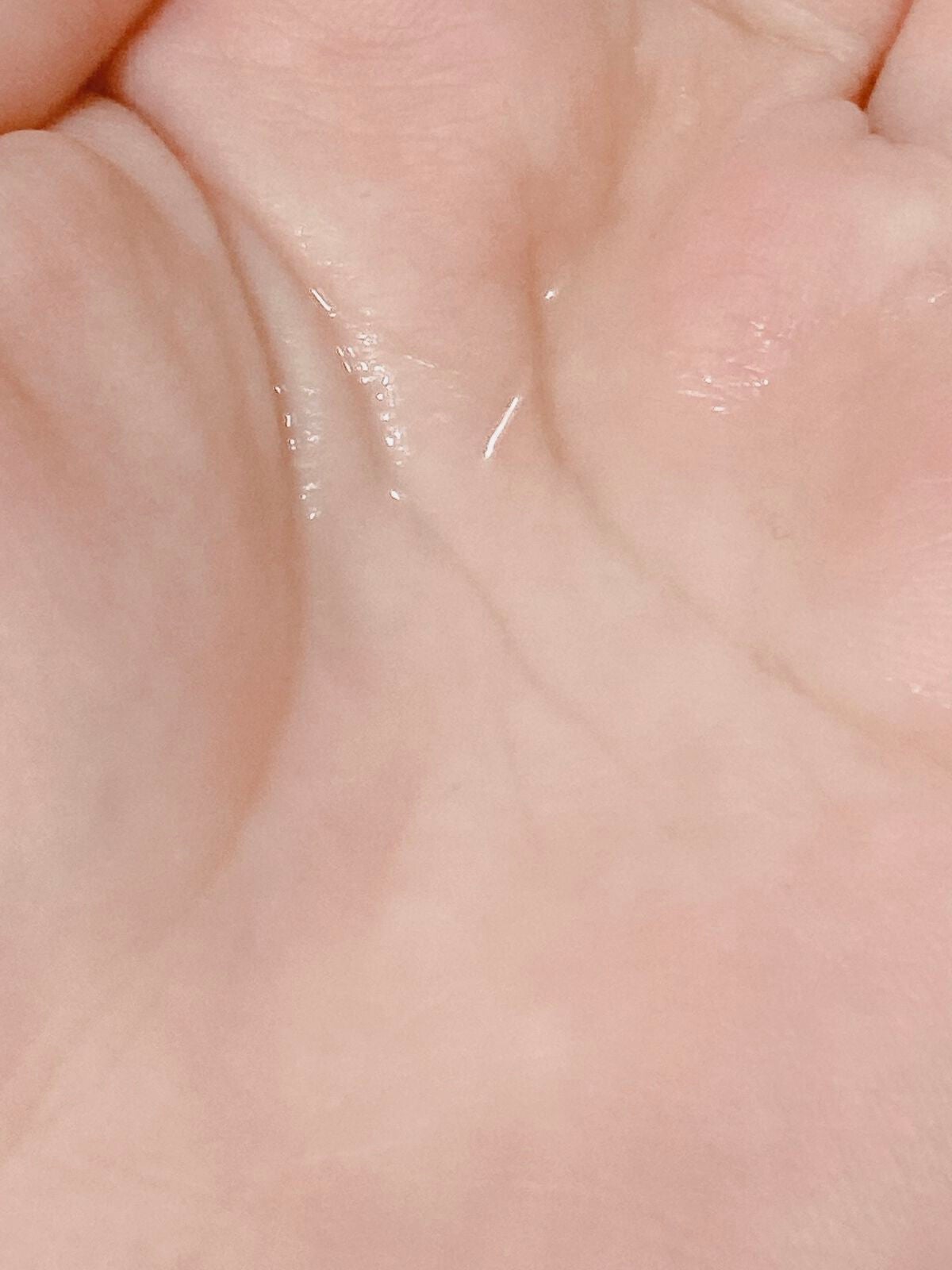 ローションVC(ビタミンC誘導体)/スキン コンディショナー/化粧水を使ったクチコミ(3枚目)