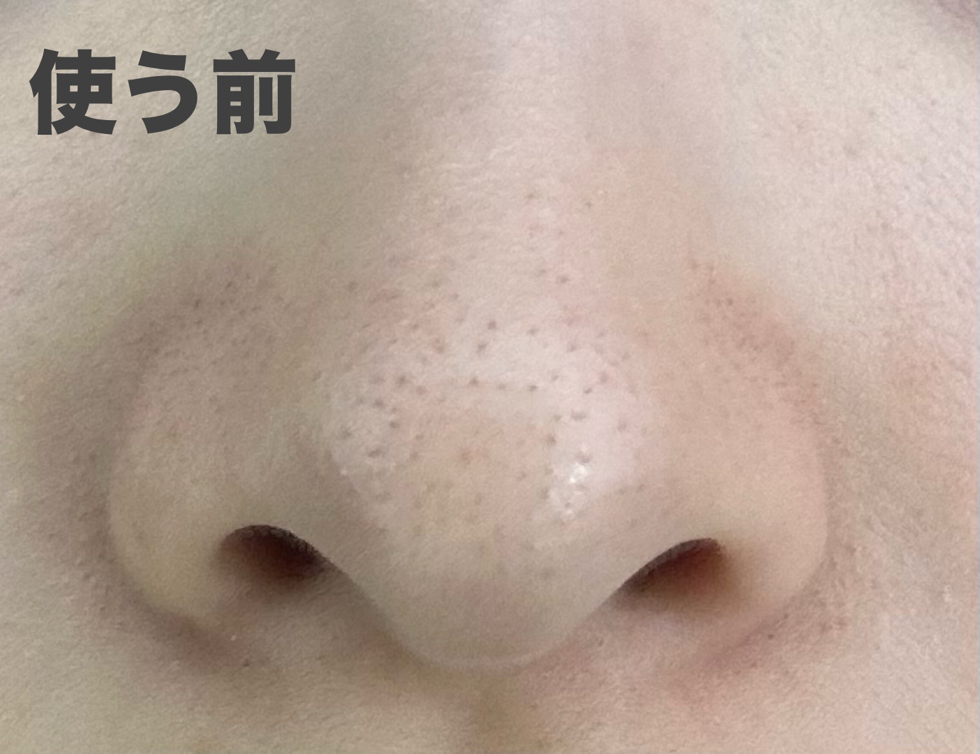 ノーモアブラックヘッド(ノーズピーリング)/One-day's you/スクラブ・ゴマージュを使ったクチコミ（2枚目）