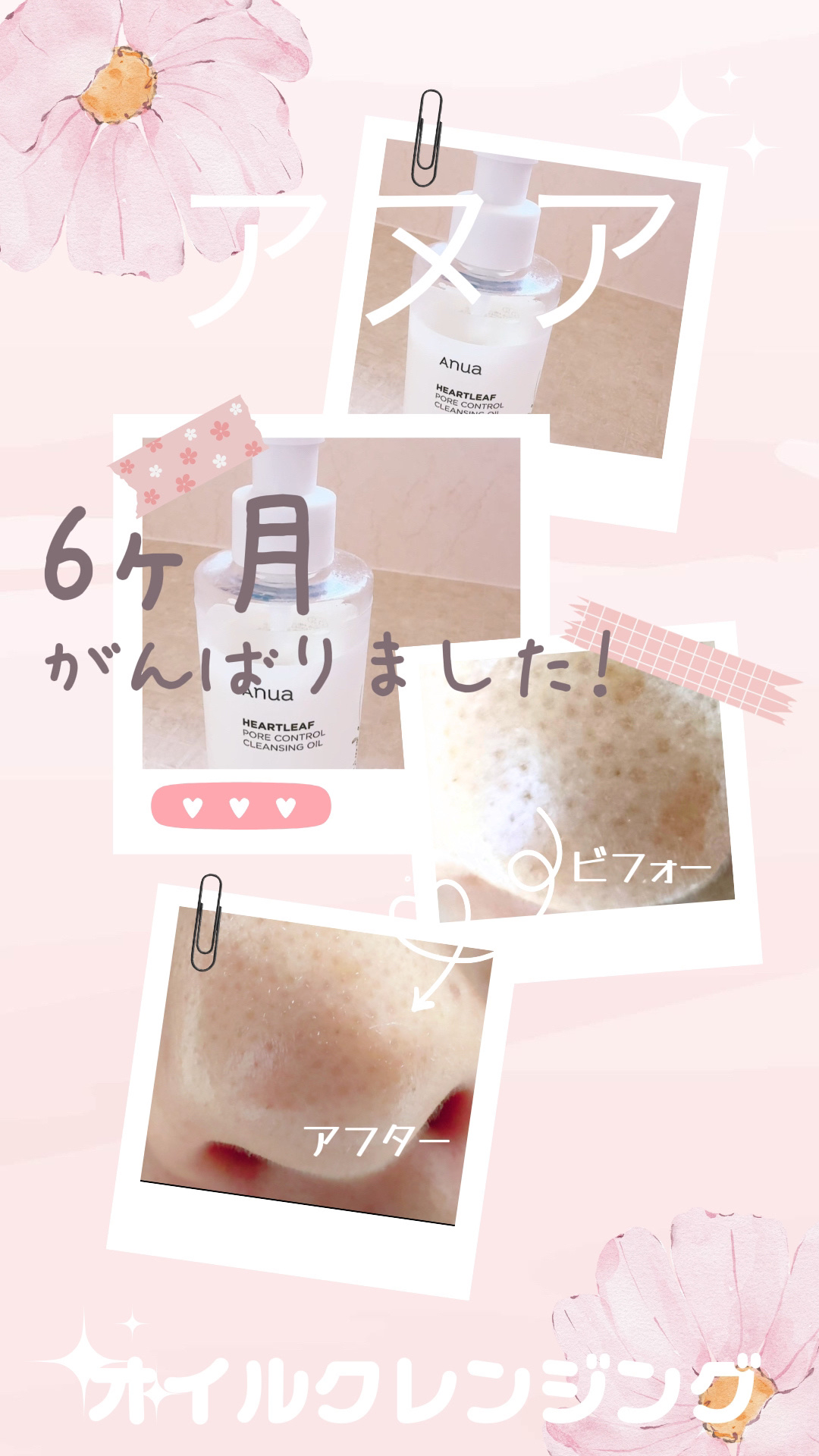 ミノン アミノモイスト モイストチャージ ミルク/ミノン/乳液を使ったクチコミ（1枚目）