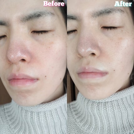 ロイヤル ウォーターピーリング IPX7完全防水/ANLAN/美顔器・マッサージを使ったクチコミ(7枚目)