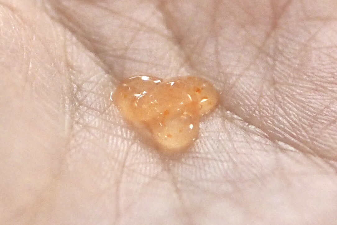 アスタリライズV3エッセンス/アトレージュ AD＋/美容液を使ったクチコミ（3枚目）