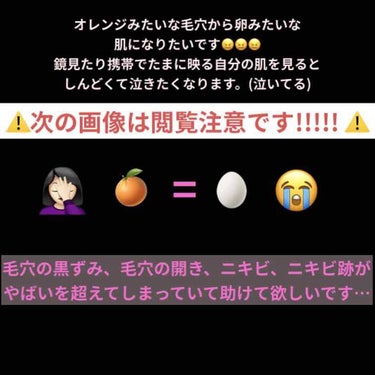 敏感肌用薬用美白美容液/無印良品/美容液を使ったクチコミ（1枚目）