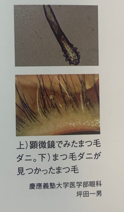 アイシャンプーロング/メディプロダクト/その他洗顔料を使ったクチコミ(5枚目)