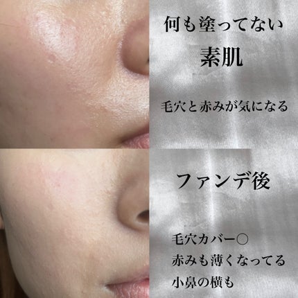 アディクション ザ ファンデーション リフトグロウ/ADDICTION/リキッドファンデーションを使ったクチコミ(2枚目)