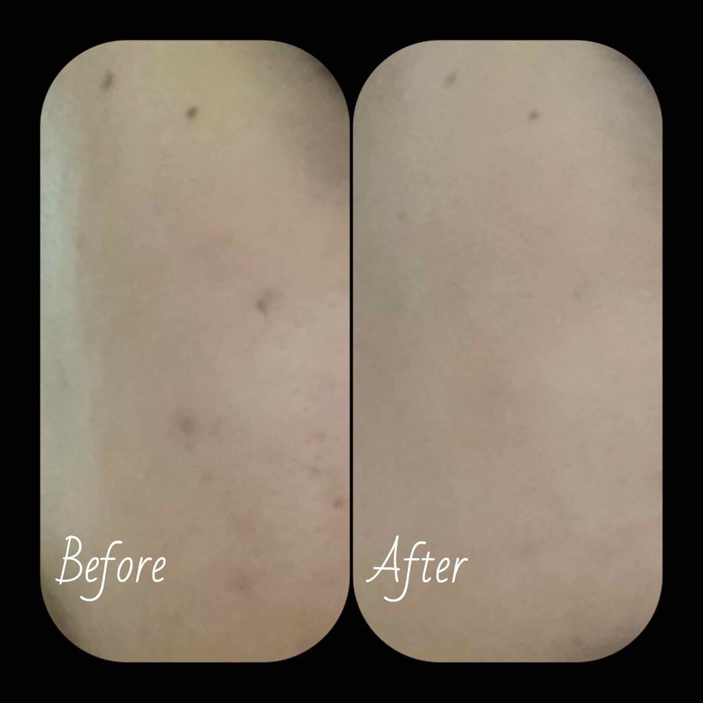 フローレス フィット/COVERMARK/クリーム・エマルジョンファンデーションを使ったクチコミ(2枚目)