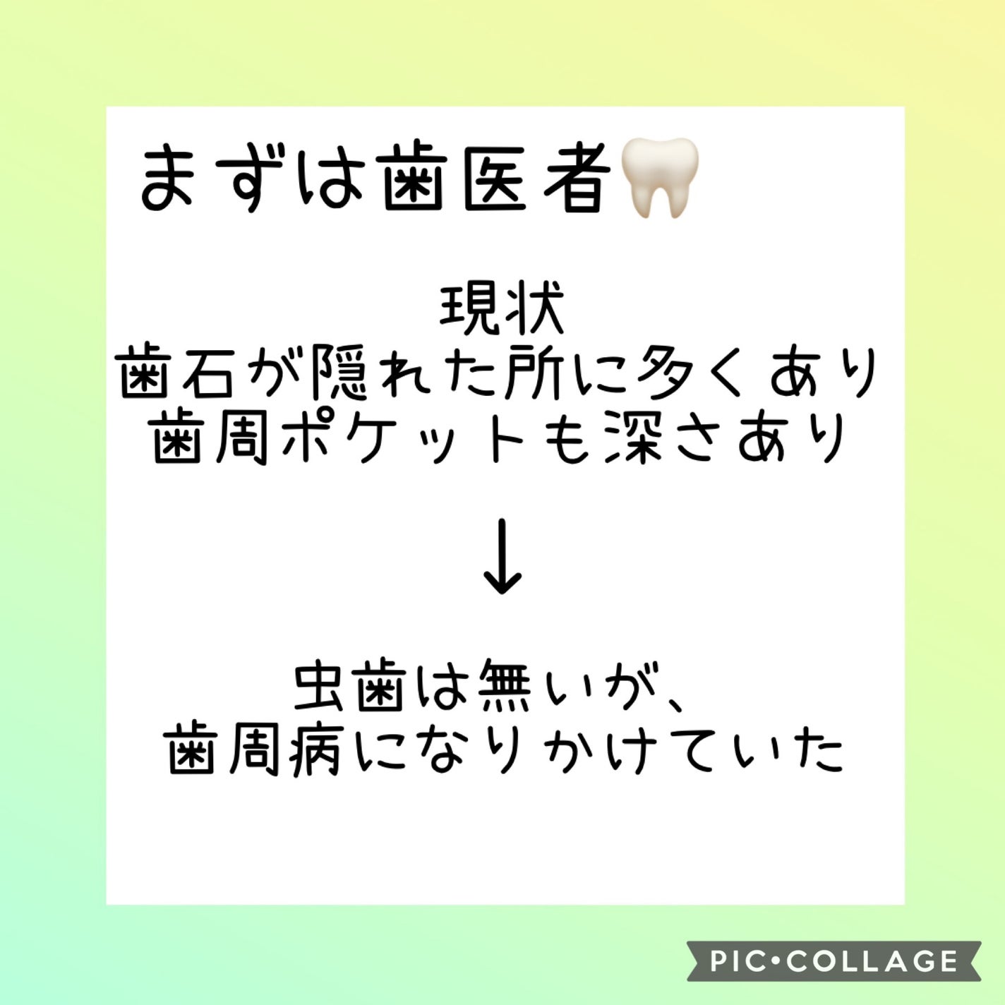 クリニカ スポンジフロス/クリニカ/デンタルフロス・歯間ブラシを使ったクチコミ(5枚目)